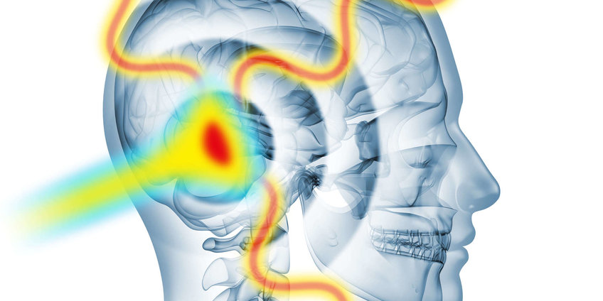 Medical Physics graphic of a human head and lasers